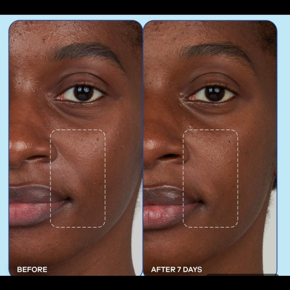 Skinfix SEALED! NIB! Barrier+ Collagen Activating Serum. 1floz/30ml. R2S!! - Picture 3 of 13
